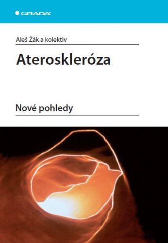 Ateroskleróza - Aleš Žák, kolektiv a - e-kniha