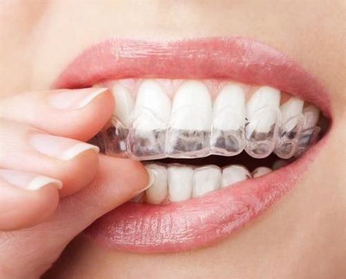 Chránič proti skřípání zubů