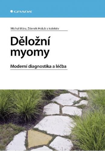 Děložní myomy - Michal Mára, Zdeněk Holub, kolektiv a - e-kniha