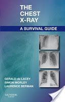 Chest X-Ray, a Survival Guide (De Lacey Gerald)(Paperback)
