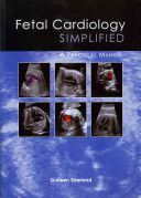 Fetal Cardiology Simplified - A Practical Manual (Sharland Gurleen)(Paperback)