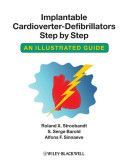 Implantable Cardioverter-defibrillators Step by Step - An Illustrated Guide (Stroobandt Roland X.)(Paperback)