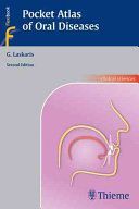 Pocket Atlas of Oral Diseases (Laskaris George)(Paperback)