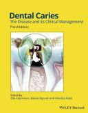 Dental Caries - The Disease and its Clinical Management (Fejerskov Ole)(Pevná vazba)
