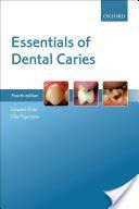 Essentials of Dental Caries (Kidd Edwina A. M.)(Paperback)