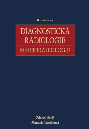Diagnostická radiologie - Zdeněk Seidl, Manuela Vaněčková - e-kniha