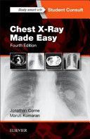 Chest X-Ray Made Easy (Corne Jonathan)(Paperback)