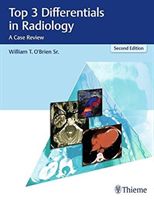 Top 3 Differentials in Radiology: A Case Review (O'Brien William T.)(Pevná vazba)