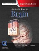 Diagnostic Imaging: Brain (Osborn Anne G.)(Pevná vazba)