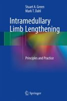 Intramedullary Limb Lengthening - Principles and Practice (Green Stuart A.)(Pevná vazba)