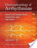 Electrophysiology of Arrhythmias - Practical Images for Diagnosis and Ablation (Ho Reginald T.)(Pevná vazba)