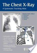 Chest X-Ray - A Systematic Teaching Atlas (Hofer Matthias)(Paperback)