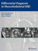 Differential Diagnosis in Musculoskeletal MRI (Hollenberg Gary M.)(Pevná vazba)