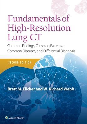 Fundamentals of High-Resolution Lung CT - Common Findings, Common Patterns, Common Diseases and Differential Diagnosis (Elicker Brett M MD)(Paperback / softback)