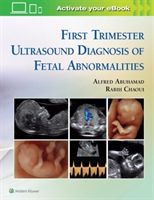 First Trimester Ultrasound Diagnosis of Fetal Abnormalities (Abuhamad Alfred Z.)(Pevná vazba)