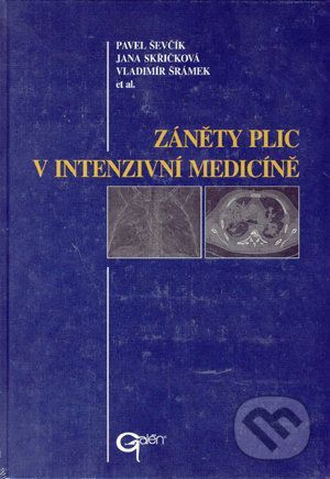 Záněty plic v intenzivní medicíně - Pavel Ševčík, Jana Skřičková, Vladimír Šrámek a kolektív
