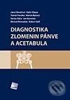 Diagnostika zlomenin pánve a acetabula - Jana Chmelová a kol.