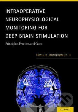 Intraoperative Neurophysiological Monitoring for Deep Brain Stimulation - Erwin B. Montgomery