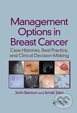 Management Options in Breast Cancer - John Benson, Ismail Jatoi