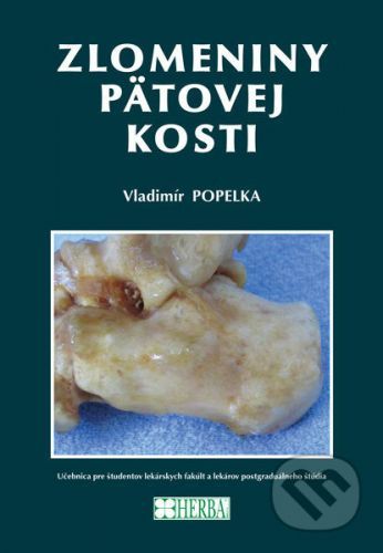 Zlomeniny pätovej kosti - Vladimír Popelka