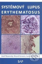 Systémový lupus erythematosus -