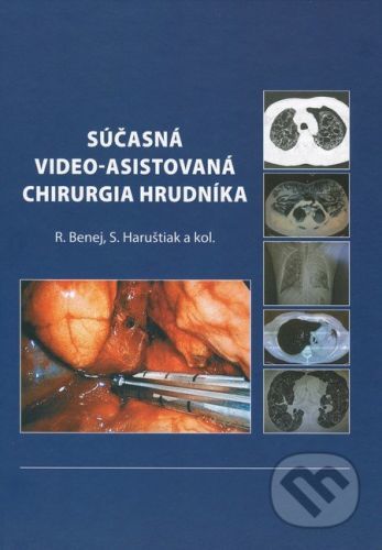 Súčasná video-asistovaná chirurgia hrudníka - Roman Benej, Svetozár Harušiak a kol.