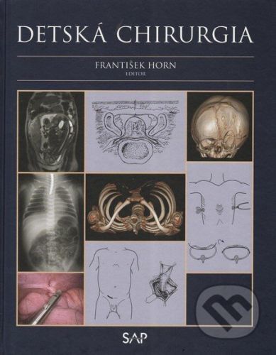 Detská chirurgia - František Horn