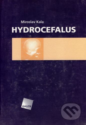 Hydrocefalus - Miroslav Kala