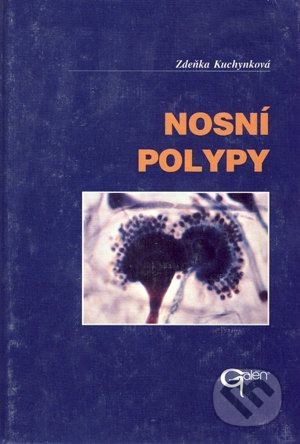 Nosní polypy - Zdeňka Kuchynková