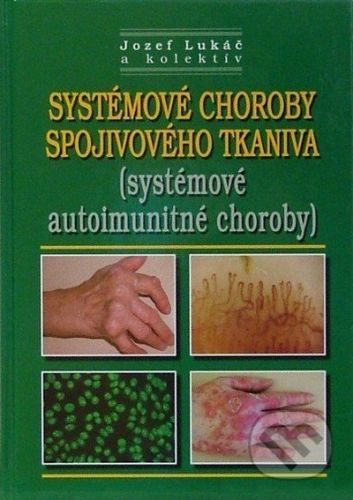 Systémové choroby spojivového tkaniva (systémové autoimunitné choroby) - Jozef Lukáč a kol.