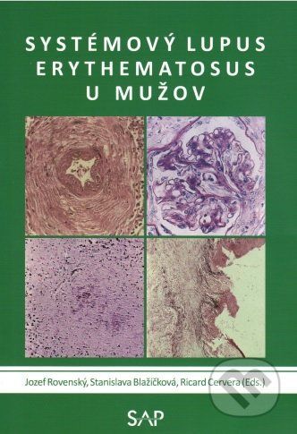 Systemovy lupus erythematosus u muzov - Jozef Rovenský, Stanislava Blažičková