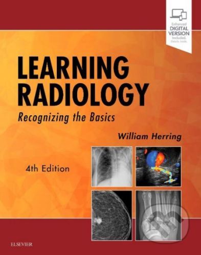 Learning Radiology - William Herring