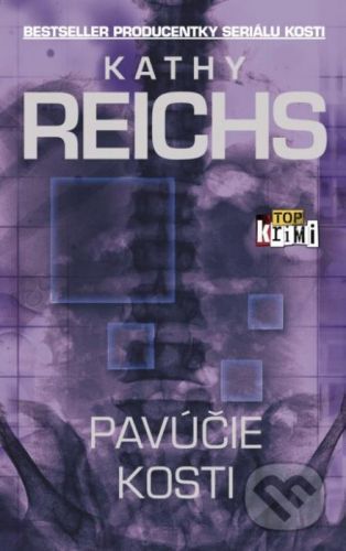 Pavúčie kosti - Kathy Reichs