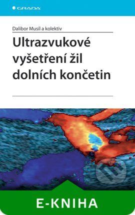 Ultrazvukové vyšetření žil dolních končetin - Dalibor Musil a kolektiv