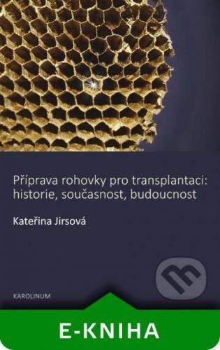 Příprava rohovky pro transplantaci - Kateřina Jirsová