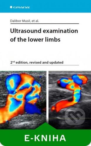Ultrasound examination of the lower limbs - Musil Dalibor a kolektiv