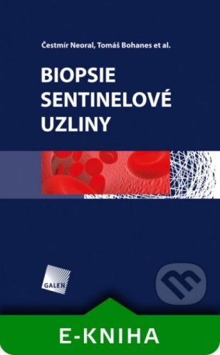 Biopsie sentinelové uzliny - Čestmír Neoral, Tomáš Bohanes a kolektív