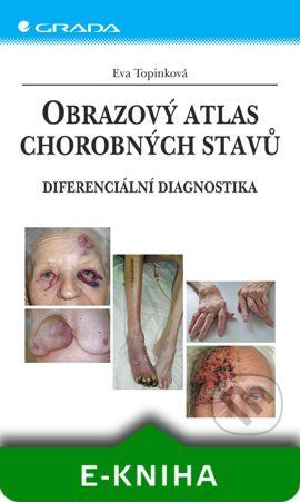 E-kniha: Obrazový atlas chorobných stavů od Topinková Eva
