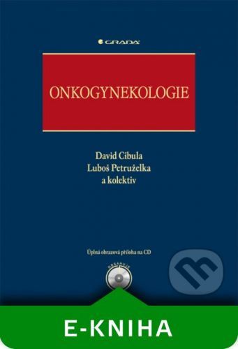 Onkogynekologie - David Cibula, Luboš Petruželka a kolektiv