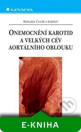 Onemocnění karotid a velkých cév aortálního oblouku - Bohuslav Čertík a kolektiv