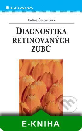 Diagnostika retinovaných zubů - Pavlína Černochová
