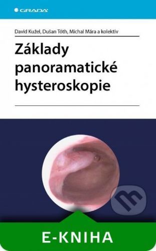 Základy panoramatické hysteroskopie - David Kužel, Dušan Tóth, Michal Mára a kolektiv