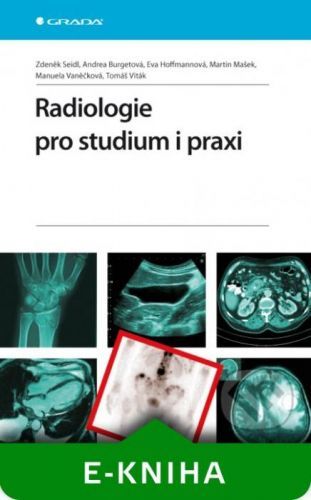 Radiologie pro studium i praxi - Zdeněk Seidl, Andrea Burgetová, Eva Hoffmannová, Martin Mašek, Manuela Vaněčková, Tomáš Viták