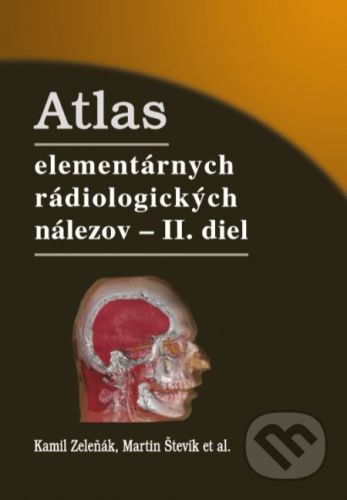 Atlas elementárnych rádiologických nálezov II - Kamil Zeleňák, Martin Števík a kolektív