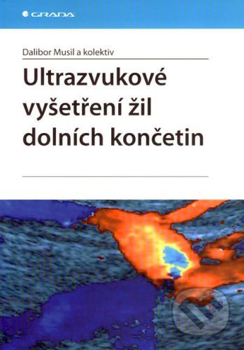 Ultrazvukové vyšetření žil dolních končetin - Dalibor Musil a kol.