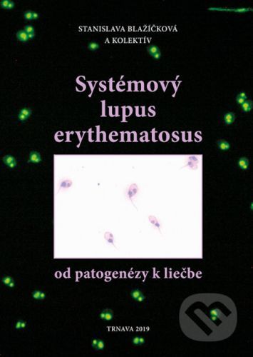 Systémový lupus erythematosus - Stanislava Blažíčková a kolektív