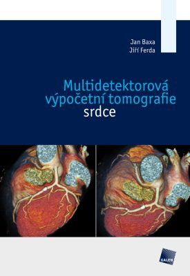 Multidetektorová výpočetní tomografie srdce - Jan Baxa, Jiří Ferda - e-kniha