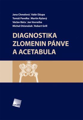 Diagnostika zlomenin pánve a acetabula - Jana Chmelová, Valér Džupa, Tomáš Pavelka, Václav Báča, Jan Vavrečka - e-kniha