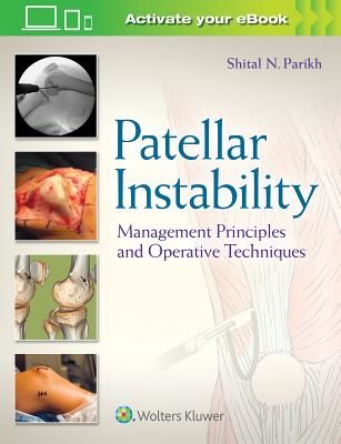 Patellar Instability - Management Principles and Operative Techniques(Pevná vazba)