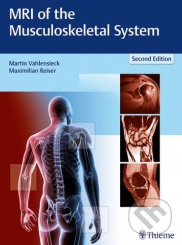 MRI of the Musculoskeletal System - Martin Vahlensieck, Maximilian Reiser
